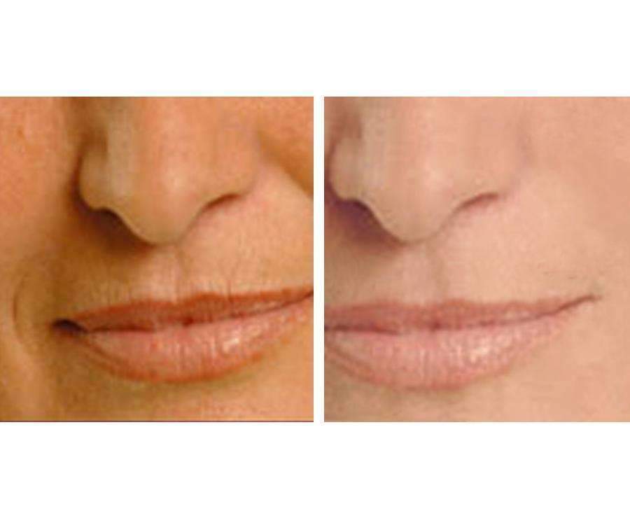 Vitamin C Night Repair Cream